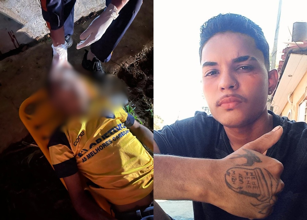 Jovem sofre grave acidente de motocicleta na BR-316, em Timon