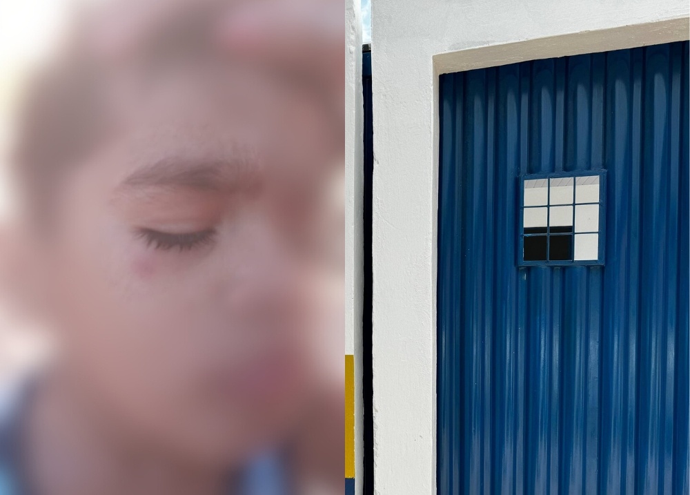 Pai denuncia negligência e agressões a filho em creche na zona Norte de Teresina