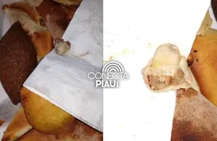 Adolescente de 14 anos encontra dedo humano em esfiha comprada por delivery (Foto: Reprodução)