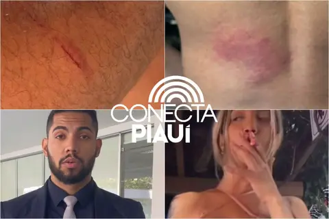 Advogado expõe marcas de agressão após confusão com a blogueira Letícia Ellen