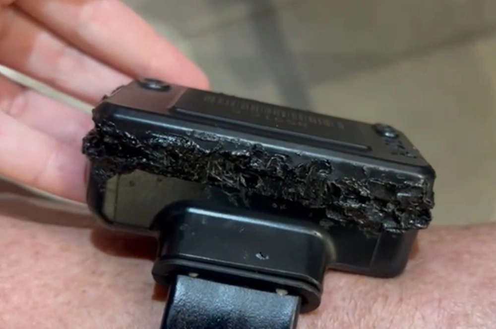 Bolsonaro admite que queimou tornozeleira com ferro de solda: 'Curiosidade'