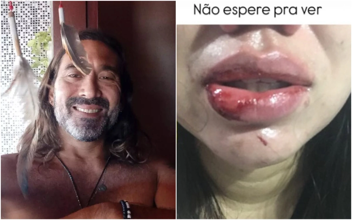 Cantor da banda Serial Lover é acusado de agredir companheira em Teresina