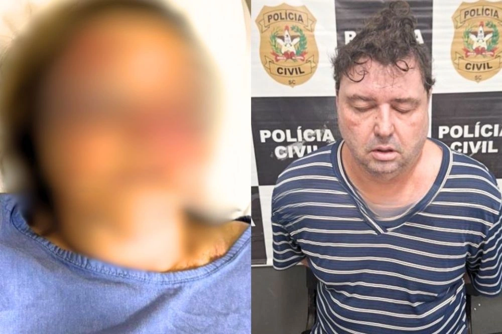 Filho espanca mãe de 83 anos após assistir derrota do seu time de futebol em SC