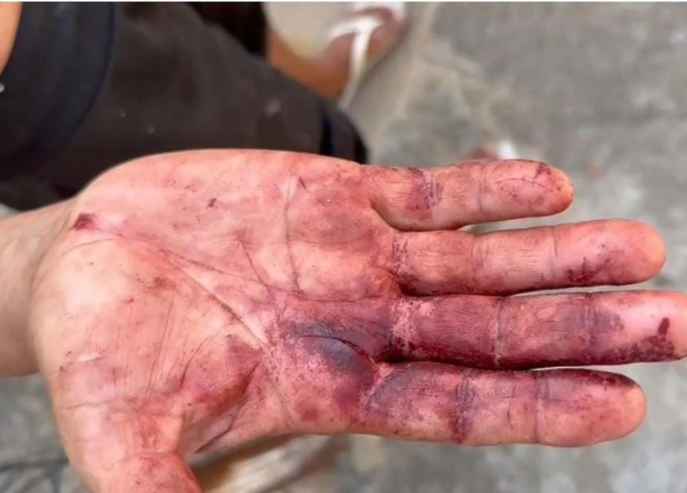 Homem é Encontrado Desacordado Após Briga com Companheiro no Bairro Nova Parnaíba