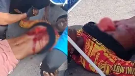 Motociclista fica com pulmão exposto após grave acidente no Maranhão (Foto: Reprodução)