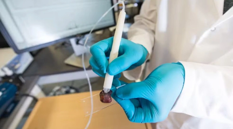 Pesquisadora brasileira cria caneta que detecta câncer em 10 segundos