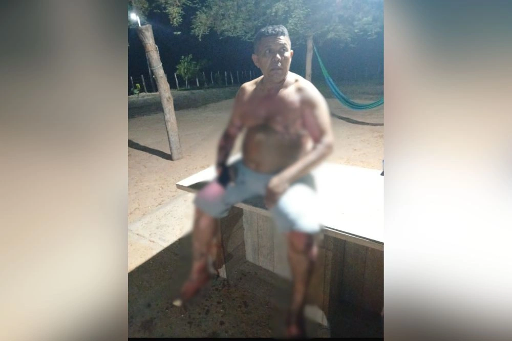 Vereador mais votado de Coivaras sofre tentativa de homicídio em ataque por ciúmes