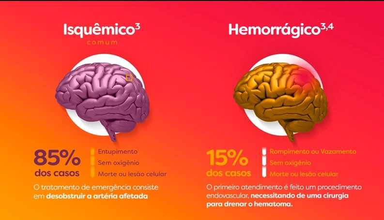 AVC ESQUÊMICO X AVC HEMORRÁGICO