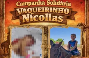 Campanha solidária arrecada doações para criança arrastada por cavalo em Pedro II (Foto: Reprodução)