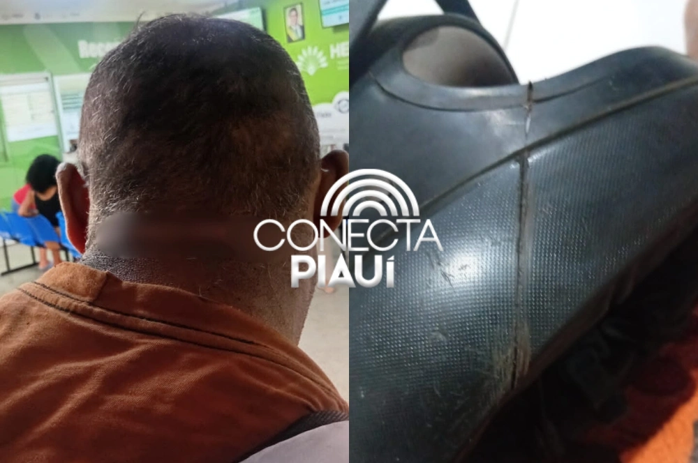 Motociclista fica ferido após ter pescoço cortado por fios de internet em Parnaíba