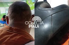 Motociclista fica ferido após ter pescoço cortado por fios de internet em Parnaíba