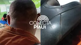 Motociclista fica ferido após ter pescoço cortado por fios de internet em Parnaíba (Foto: Reprodução)