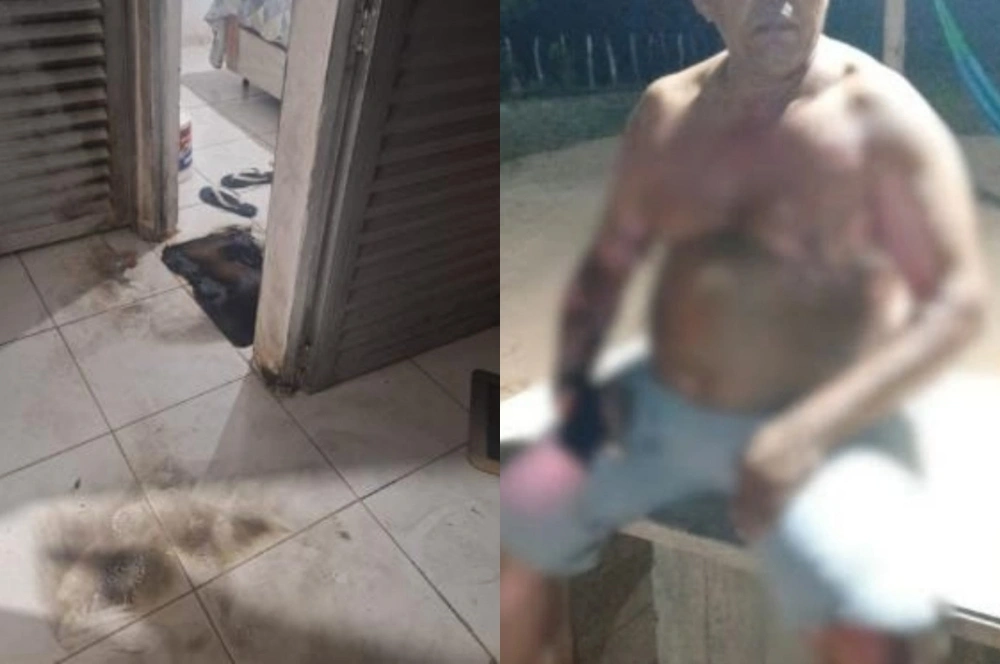 Mulher é presa por incendiar casa e deixar vereador gravemente ferido no Piauí