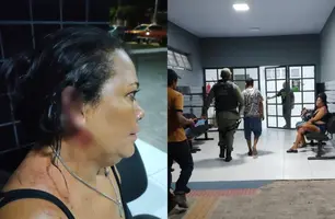 Mulher fica ferida após discussão por aluguel no bairro Piauí, em Parnaíba (Foto: Folha do Delta/Conecta Piauí)