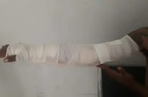 Homem é baleado no braço durante tentativa de homicídio em município no Piauí (Foto: Reprodução)