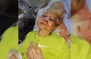 Idosa agredida no DF (Foto: Reprodução/Metropoles)