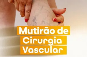 Passagem Franca realiza Mutirão de Cirurgia Vascular para Varizes (Foto: Reprodução/Redes Sociais)