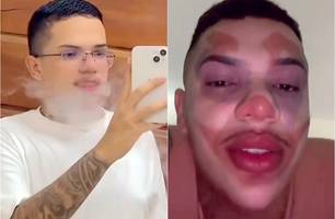 Lokinho (Foto: Reprodução)