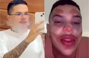 Lokinho (Foto: Reprodução)