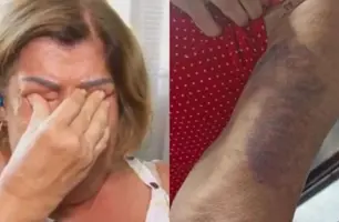 Professora é espancada após cobrar tarefa de casa de um aluno de 7 anos (Foto: Reprodução)