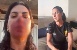 TJ-PI repudia agressão contra oficial de justiça de MG que teve nariz quebrado (Foto: Reprodução)