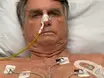Jair Bolsonaro deve ter alta hospitalar nos próximos dias, indica boletim médico