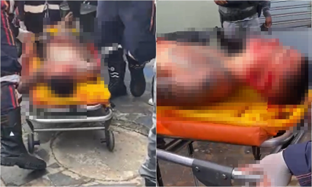 Criminoso baleado no rosto durante tentativa de assalto em Teresina