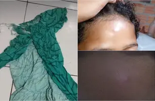 Família de criança autista de 10 anos denuncia agressões do padrasto em Teresina (Foto: Reprodução)