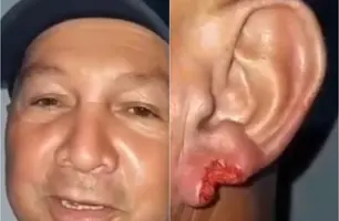 Após beijo, mulher arranca pedaço da orelha de homem durante festa em Piripiri (Foto: Reprodução/ Piripiri Repórter)