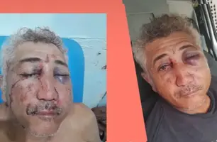 Homem é ferido por motociclista que estava dando 'grau' em Barras (Foto: Reprodução)