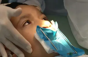 Lula sanciona lei que oferta cirurgia reconstrutiva de lábio leporino no SUS (Foto: Divulgação TV Brasil)