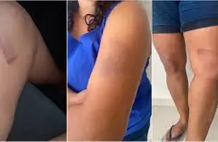 Justiça condena supermercado Mateus por tortura em cliente (Foto: Reprodução)