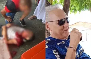 Sargento baleado em tentativa de assalto em Teresina está em estado grave (Foto: Reprodução)