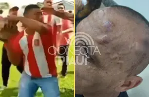 Árbitro é agredido com pedrada após cobrança de pênalti no Maranhão (Foto: Reprodução/Redes Sociais)