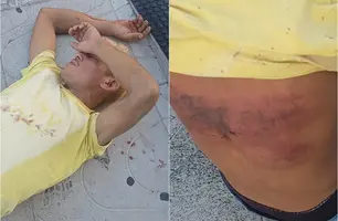 Homem é sequestrado, espancado e abandonado em via pública em Parnaíba (Foto: Reprodução)