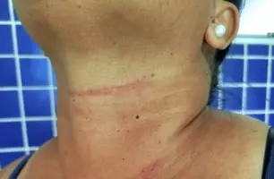 Mulher foge de agressor e aciona PM em Monte Alegre (Foto: Reprodução/PM/Portal Gurguéia)