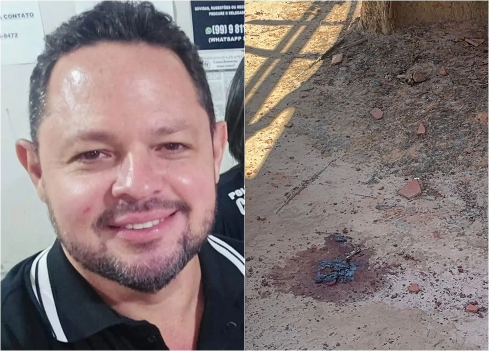 Policial ferido em operação que matou delegado passa por cirurgia em Teresina