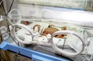 Projeto propõe equidade na imunização de recém-nascidos prematuros pelo SUS (Foto: Reprodução)