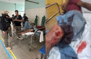 Homem parte para cima de policiais com faca, é baleado e preso em Teresina (Foto: Reprodução)