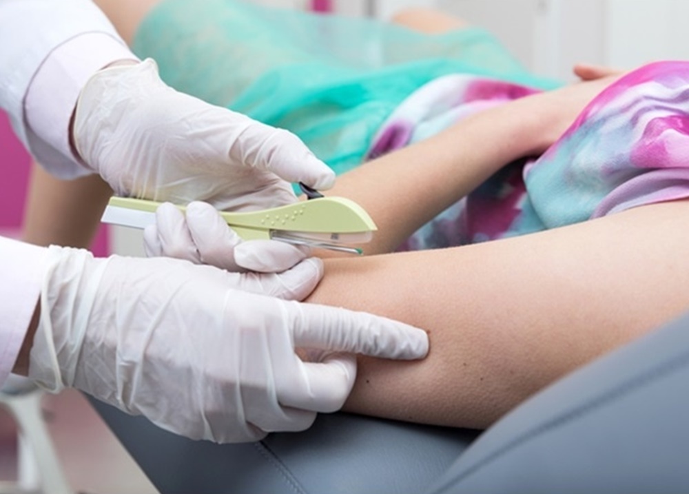 Inserção de implante contraceptivo