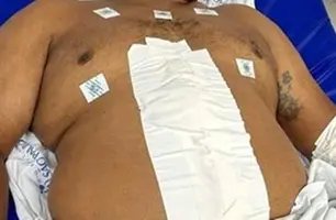 Saiba como está o segurança baleado em Timon próximo ao Banco do Brasil (Foto: Reprodução)