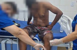 Homem tem casa invadida e sofre tentativa de homicídio em São Pedro do Piauí (Foto: Divulgação/PMPI)