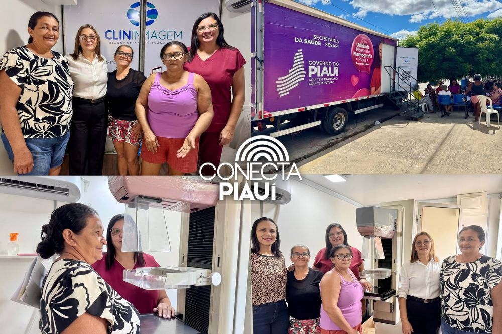 Hugo Napoleão recebe Carreta da Mamografia com atendimentos gratuitos