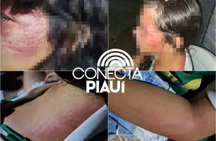 Menina de 12 anos é resgatada após denúncia de maus-tratos em Miguel Alves (Foto: Reprodução)