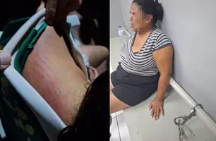 Menina de 12 anos é resgatada com sinais de agressão em Miguel Alves; mãe é presa (Foto: Reprodução)