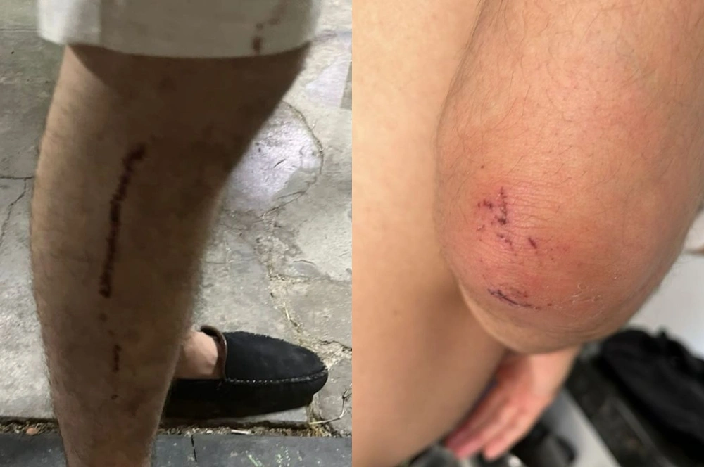 Casal gay sofre ofensas e agressão de estudante de medicina em Parnaíba