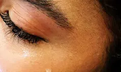 Saúde mental lidera preocupações globais, aponta pesquisa internacional