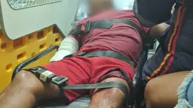 Comerciante é baleado em frente ao próprio bar em Luís Correia (Foto: Reprodução)