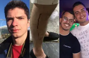 Estudante de medicina é condenado por ofender e agredir casal gay em Parnaíba (Foto: Reprodução)