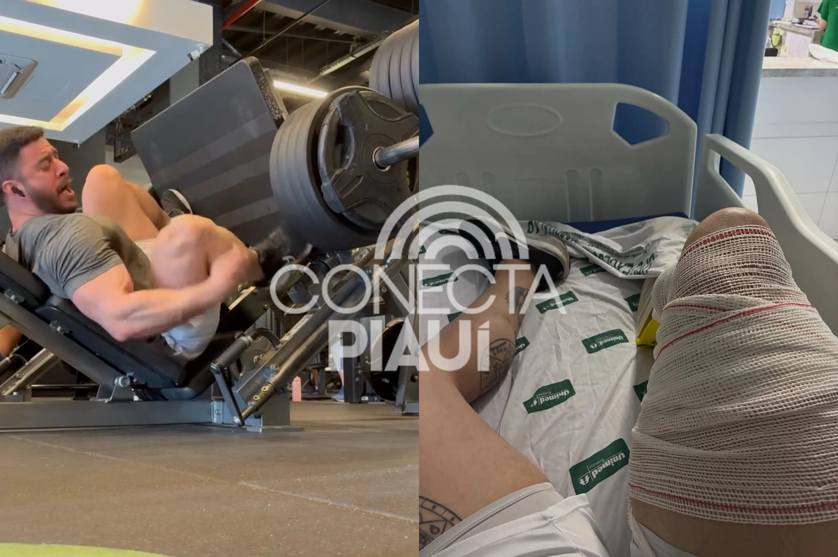 Estudante sofre lesão no joelho em Teresina